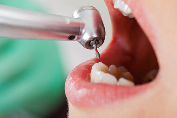 Best Pediatric Emergency Dentist in Salem Heights, OH